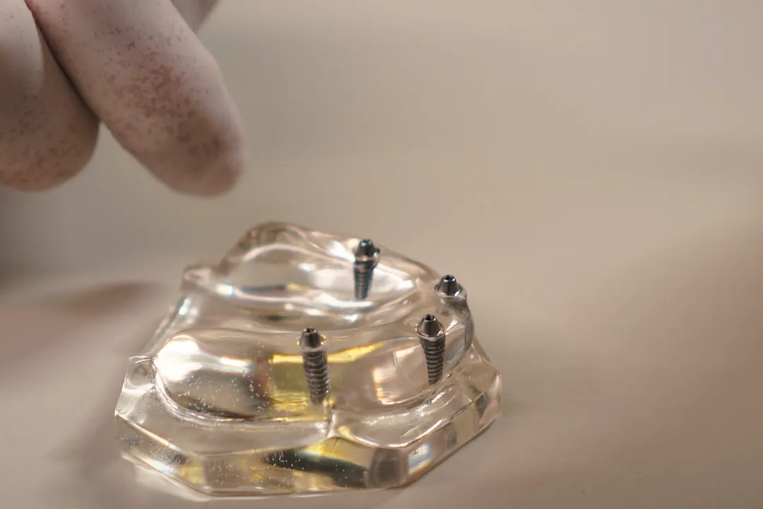 Modelo transparente de arcada com quatro implantes dentários